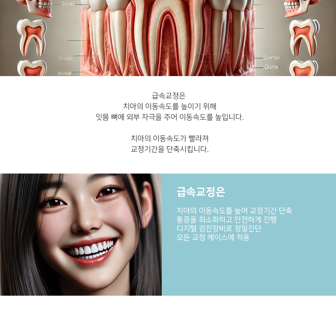 급속교정
