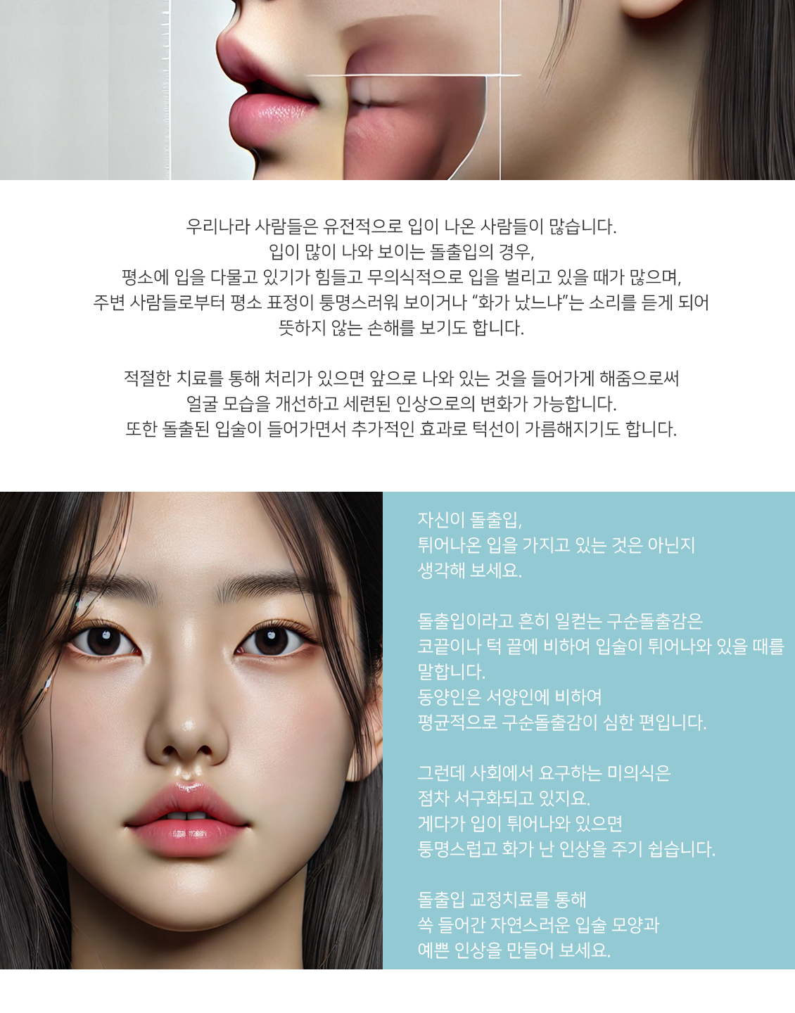 돌출입교정