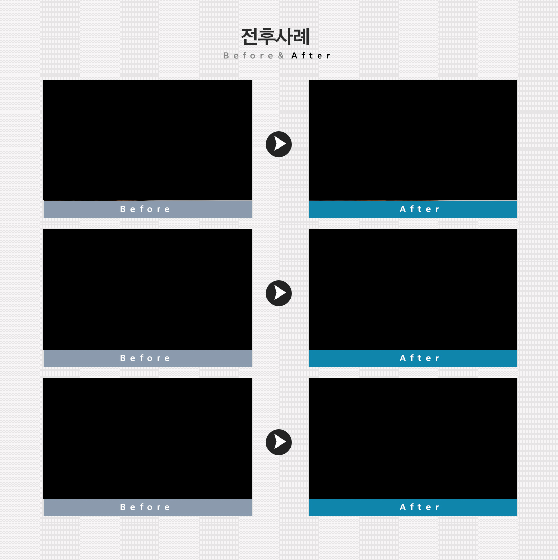 주걱턱교정 전후케이스